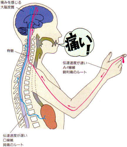 原因による分類【痛みの分類③】: からだのし 